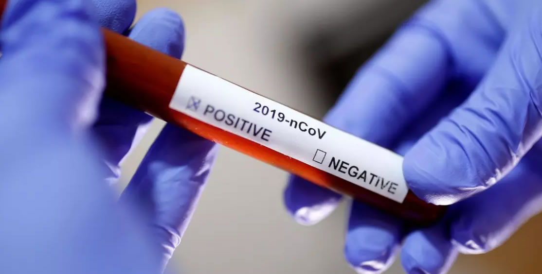 coronavirus