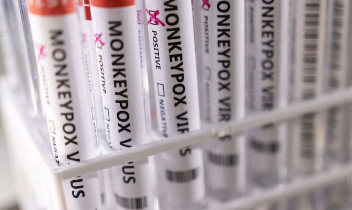 2022-05-23t222423z_1_lynxnpei4m100_rtroptp_4_health-monkeypox_1 (1)