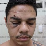As fotos do militar da FAB após esfaquear mulher, sargento do Exército