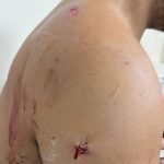 Violência e brigas no trânsito explodem no DF. Relembre casos recentes