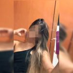 Jovem escalpelada em kart pede ajuda para colocar prótese capilar