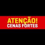 Pit-bull sem focinheira ataca e fere rosto de babá em Águas Claras