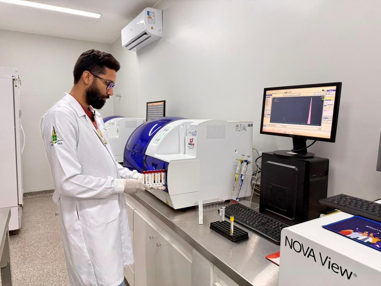 29.12. Novo exame de sangue. Foto Divulgação Agência Saúde-DF